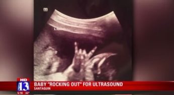 Orang Tua di Utah (US) Berbagi Foto USG Anak Mereka Dengan Salam Jari Heavy Metal