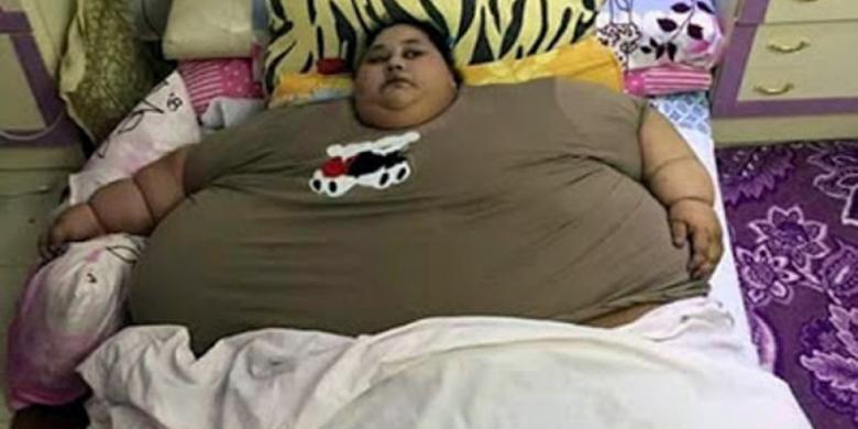 Wanita "Terberat di Dunia" Kurangi 100 Kg Bobot Tubuhnya Dalam Sehari