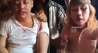 Soal Habib Bahar yang Dilaporkan atas Dugaan Penganiayaan Anak di Bogor