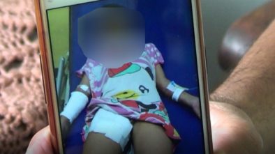Viral Anak Yatim Piatu Disiram Air Panas dan Diperlakukan Seperti Pembantu Oleh Ibu Angkatnya