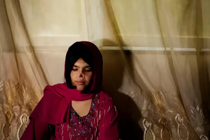 Kisah Perempuan Korban KDRT Sekarang Jadi Duta PBB untuk Perempuan