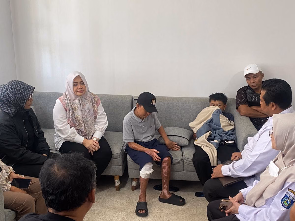 Korban Pembakaran Ponpes, Pemprov NTB Jamin Perawatannya