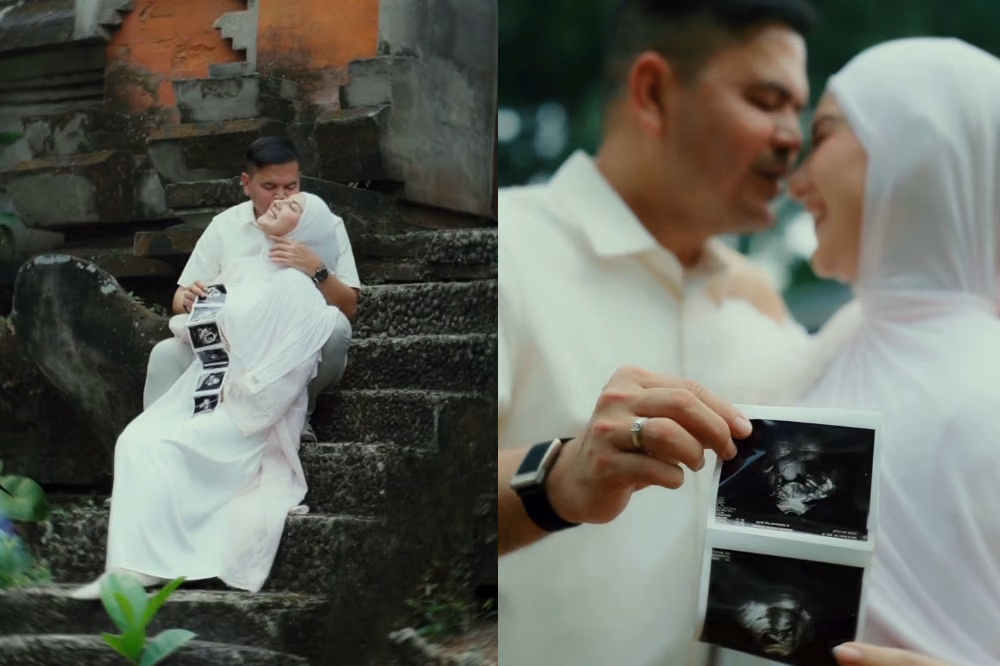 Irish Bella Hamil Anak Haldy Sabri Setelah Dua Tahun Menikah